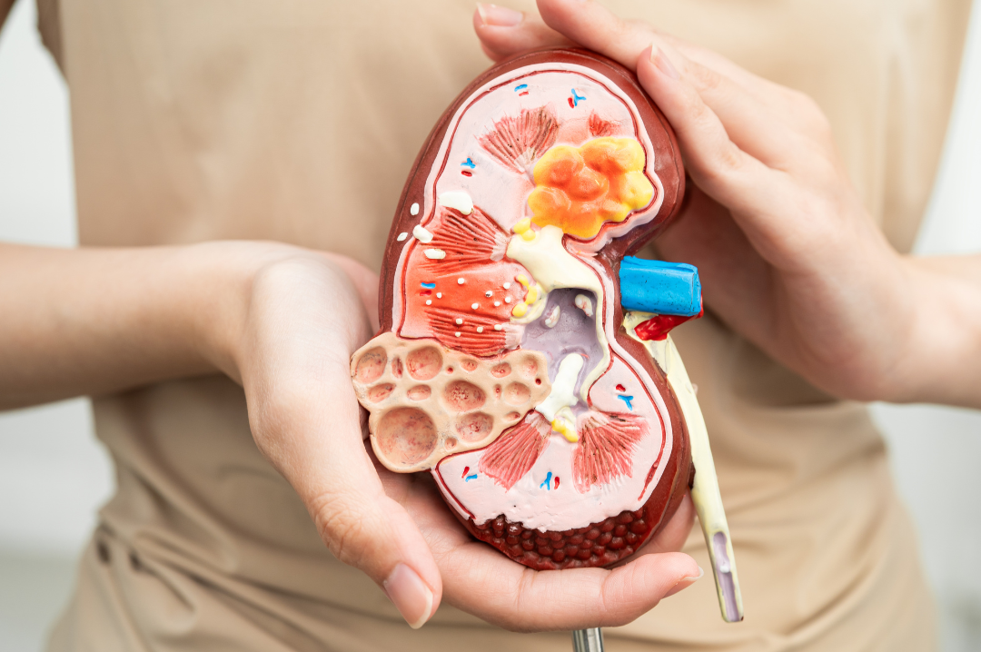 Os 4 Pilares do Tratamento da Doença Renal do Diabetes: Uma Revolução no Cuidado Nefrológico