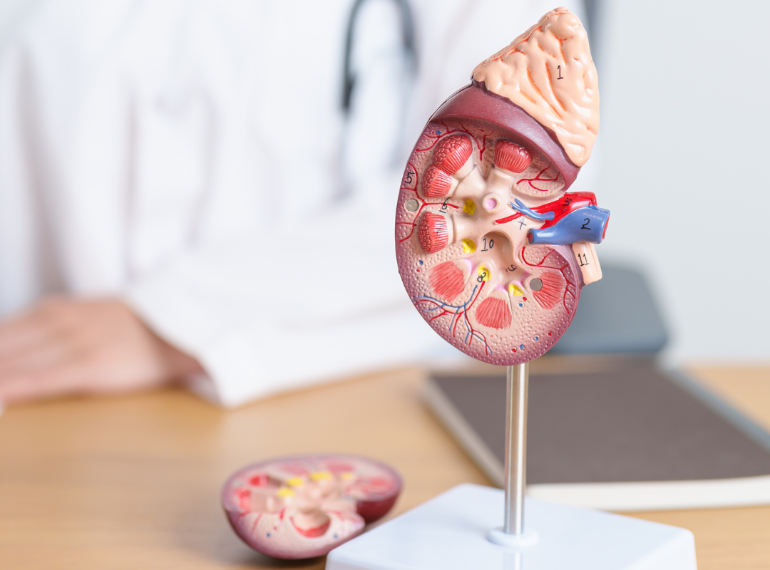 iSGLT2 na Doença Renal SEM Diabetes: A Nova Fronteira da Nefroproteção